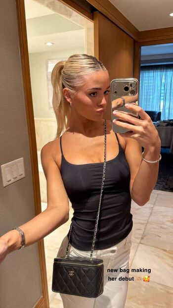 Livvy Dunne