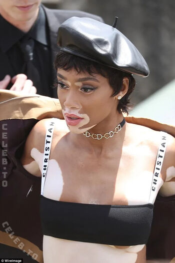 Winnie Harlow