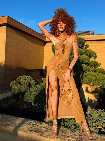 Winnie Harlow