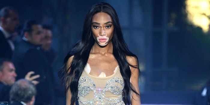 winnieharlow